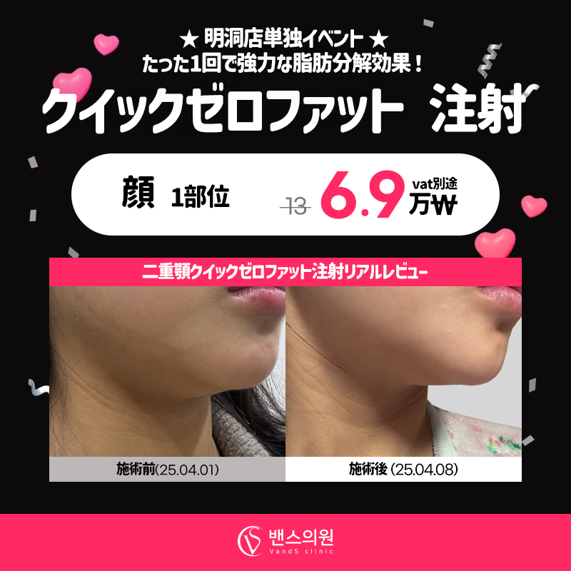 YOURCLINICJP's tweet photo. 1回で瘦せるってホント⁉《新登場》#ベンスクリニック の #クイックゼロファット でしんどいダイエットはもう終わり‼たった1回で確実なサイズダウン🌟
#ホンデ #江南 #明洞 

顔1部位6.9万₩
ボディー1部位9.9万₩
詳細はこちら➡️https://t.co/yCXmkm7TO4

 RT&amp;フォローで4月以降も適用可能✨
#美容 https://t.co/uU6YN5nqFH