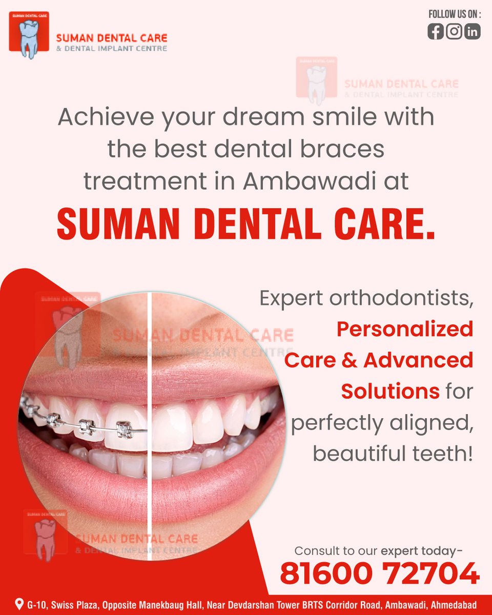sumandentalcare's tweet photo. 😄 Achieve Your Dream Smile! Get the best dental braces treatment in Ambawadi at Suman Dental Care. 

📞 8160072704
🌐 https://t.co/lR15z6Ly13

#BracesTreatment #AmbawadiDentist #SumanDentalCare #Orthodontics #DreamSmile #DentalBraces #PerfectSmile #BeautifulTeeth #allon4implants https://t.co/ZmX2ilLPZo