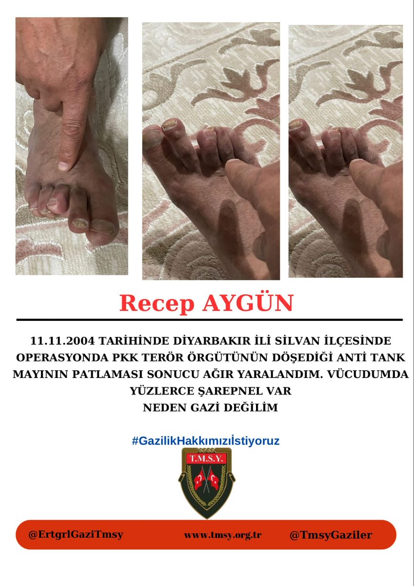 TMSY YÖRÜK ALİ SARI 2 (@alisar26694) on Twitter photo #GazilikHakkımızıİstiyoruz
SAYIN DEVLET BÜYÜKLERİMİZ TERÖRLE MÜCADELEDE YARALANAN SIVASIZ VE KERPİÇ EVLERİN ÇOÇUKLARI GAZİLİK ONURLARINI VE MADALYALARINI İSTİYOR
<a href="/RTErdogan/">Recep Tayyip Erdoğan</a>
<a href="/dbdevletbahceli/">Devlet Bahçeli</a>
<a href="/celebimehmet/">celebi59</a> <a href="/zorlu77/">Prof.Dr.Kürşad ZORLU</a>
<a href="/leventalyyildiz/">Levent Ali YILDIZ</a>
<a href="/mhrmkurt/">Muharrem KURT</a> <a href="/SayimMadak/">Dr. Sevim Sayım Madak 🇹🇷</a>
<a href="/MahinurOzdemir/">Mahinur Özdemir Göktaş</a> m9 #GazilikHakkımızıİstiyoruz
SAYIN DEVLET BÜYÜKLERİMİZ TERÖRLE MÜCADELEDE YARALANAN SIVASIZ VE KERPİÇ EVLERİN ÇOÇUKLARI GAZİLİK ONURLARINI VE MADALYALARINI İSTİYOR
<a href="/RTErdogan/">Recep Tayyip Erdoğan</a>
<a href="/dbdevletbahceli/">Devlet Bahçeli</a>
<a href="/celebimehmet/">celebi59</a> <a href="/zorlu77/">Prof.Dr.Kürşad ZORLU</a>
<a href="/leventalyyildiz/">Levent Ali YILDIZ</a>
<a href="/mhrmkurt/">Muharrem KURT</a> <a href="/SayimMadak/">Dr. Sevim Sayım Madak 🇹🇷</a>
<a href="/MahinurOzdemir/">Mahinur Özdemir Göktaş</a> m9