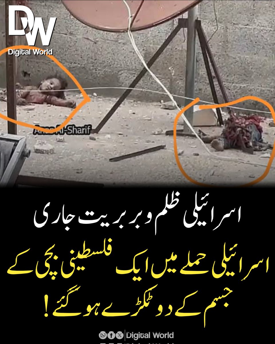 🔴 اسرائیلی ظلم و بربریت جاری

اسرائیلی حملے میں ایک فلسطینی بچی کے جسم کے دو ٹکڑے ہو گئے!
