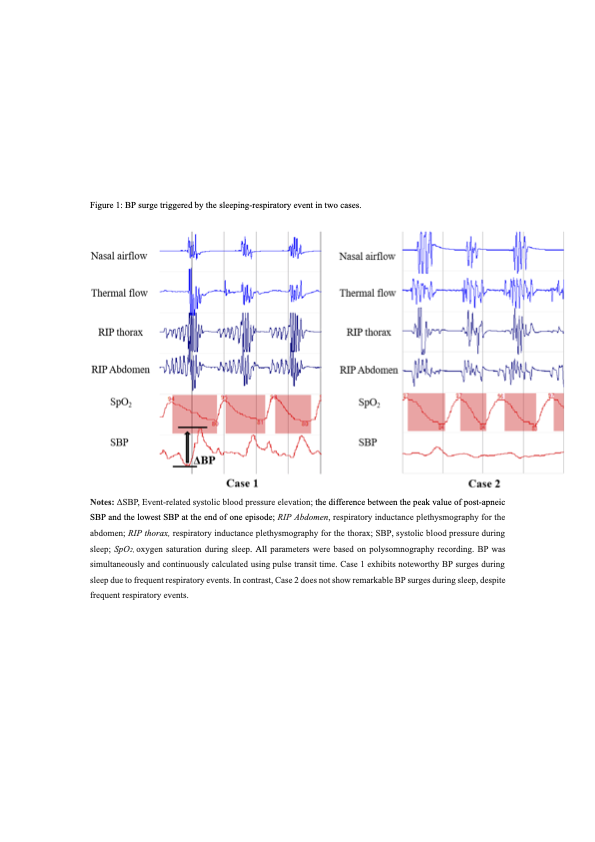 Sleep and Breathing Highlight  rdcu.be/ecBlK 
New and different perspective to explore the nocturnal blood pressure surge in patients with OSA.
<a href="/nikolaus_netzer/">Nikolaus Netzer Prof. Prof. (Hon) Dr.med.</a> @ESRC_Sleep <a href="/BritishSleepSoc/">BritishSleepSociety</a> <a href="/ResearchSleep/">Sleep Research Society</a> <a href="/ClinMedJournals/">Springer Medicine</a> <a href="/SpringerSurgery/">Springer Nature Surgery</a>