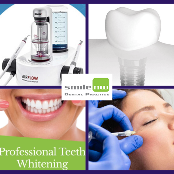 LaurelLeafChat's tweet image. 🍃🦷 From misalignment to gaps, Smile NW's orthodontic solutions can perfect your smile. Contact them for an initial chat 🔗  bit.ly/3Gpqmtm
#TeethMisalignment #OrthodonticSolutions #OrthodontistLondon #PerfectSmile #OrthodontistTempleFortune #SmileNW #DentistLondon