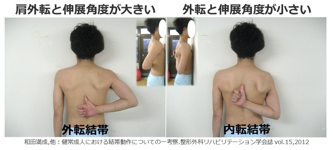 a0YP4LHjCC27121's tweet photo. 背骨に沿って母指を挙げていくと、外転結帯(Th7程度まで)から内転結帯を行うことが多いと思います。その際に、肩の伸展角度が小さくなって、内旋角度が大きくなっています。より高位まで母指を挙げようと思うと、伸展可動域より内旋可動域が必要になるかもしれません！
#肩甲上腕関節 #肩甲骨 #winging https://t.co/rocdYRua2m