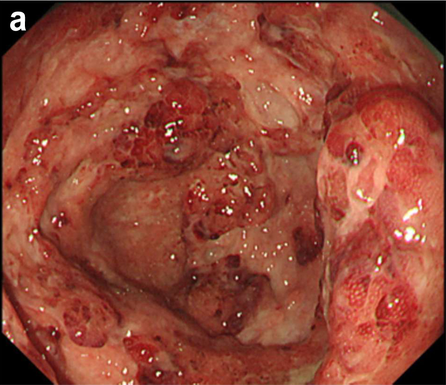 New Issue Out!!! 
Read our latest published articles in Journal of Clinical Medicine Research!
jocmr.elmerjournals.com/jocmr/issue/vi…