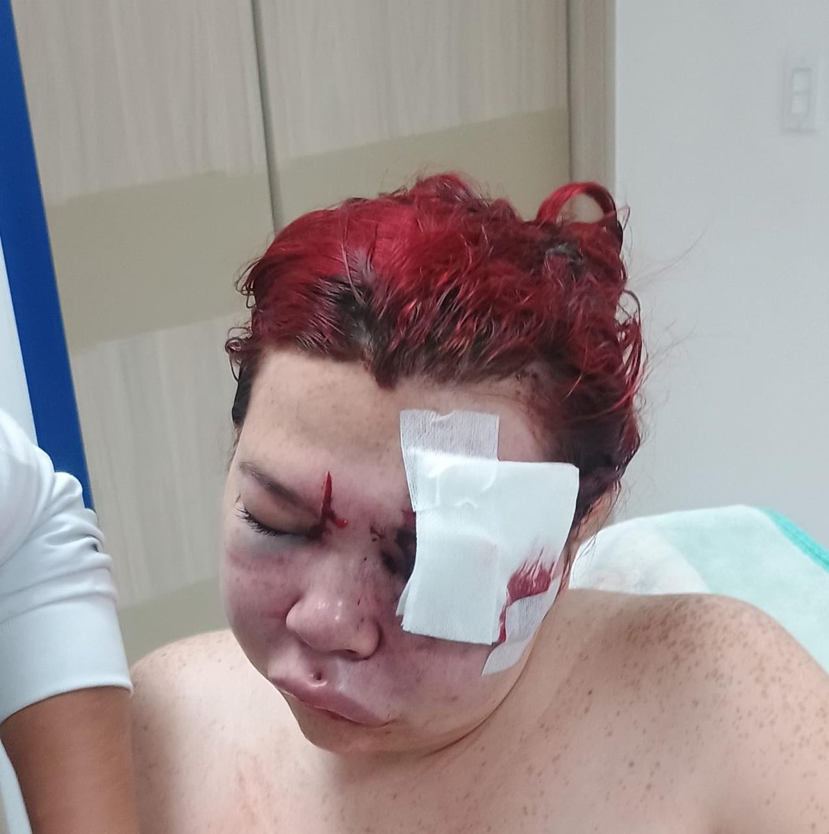 BallesterosLeo's tweet image. A la cárcel ciudadano venezolano que golpeó con sevicia a joven mujer en Socha Cundinamarca cuando ella llegaba a su vivienda… Tendrá que responder por tentativa de homicidio #Paula #PoliciaSoacha #MañanaExpress