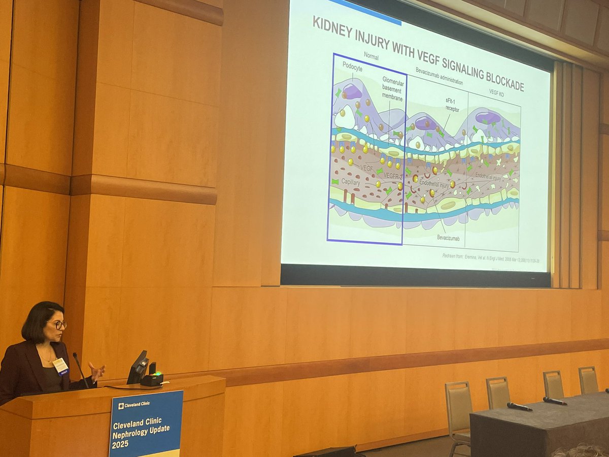 Ali Mehdi (@alimehdimd) on Twitter photo And now on to targeted cancer therapy and kidney injury. Hypertension, proteinuria, TMA, and AKI.
#CCNephUpdate25 <a href="/HerrmannMd/">Sandra Herrmann MD, FASN</a>
<a href="/CleClinicKidney/">Cleveland Clinic Kidney Medicine</a> And now on to targeted cancer therapy and kidney injury. Hypertension, proteinuria, TMA, and AKI.
#CCNephUpdate25 <a href="/HerrmannMd/">Sandra Herrmann MD, FASN</a>
<a href="/CleClinicKidney/">Cleveland Clinic Kidney Medicine</a>