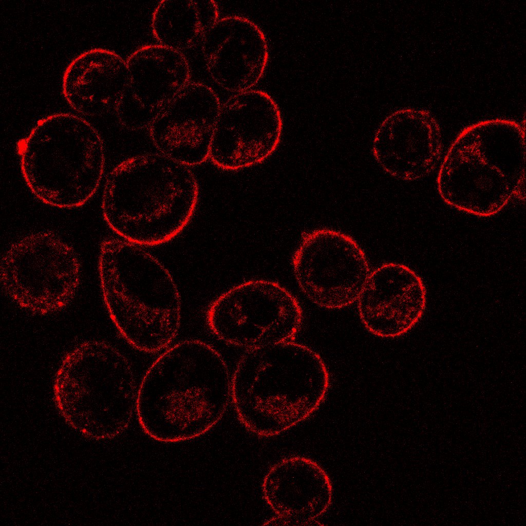 🔬Keep Calm😉
"¿Estrés? Sólo oxidativo..." 
Autor: Jorge M. Herrero-Lab. M.I. Sánchez
<a href="/JorgeMHerrero/">Jorge</a> <a href="/MetCan_Lab/">METCAN</a>
#ConcursoSEMOC #Microscopía <a href="/IIBmCSICUAM/">IIBM</a>
<a href="/REMOABioimaging/">REMOA-Spanish Network for Advanced Microscopy</a> <a href="/PPBioImaging/">PPBI-Portuguese Platform of BioImaging</a>