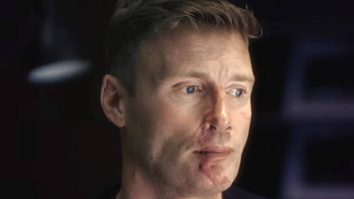 dailystar's tweet image. Freddie Flintoff&apos;s Top Gear crash injury exposed after &apos;fearing he had no face&apos; #freddieflintoff #topgear dailystar.co.uk/showbiz/freddi…