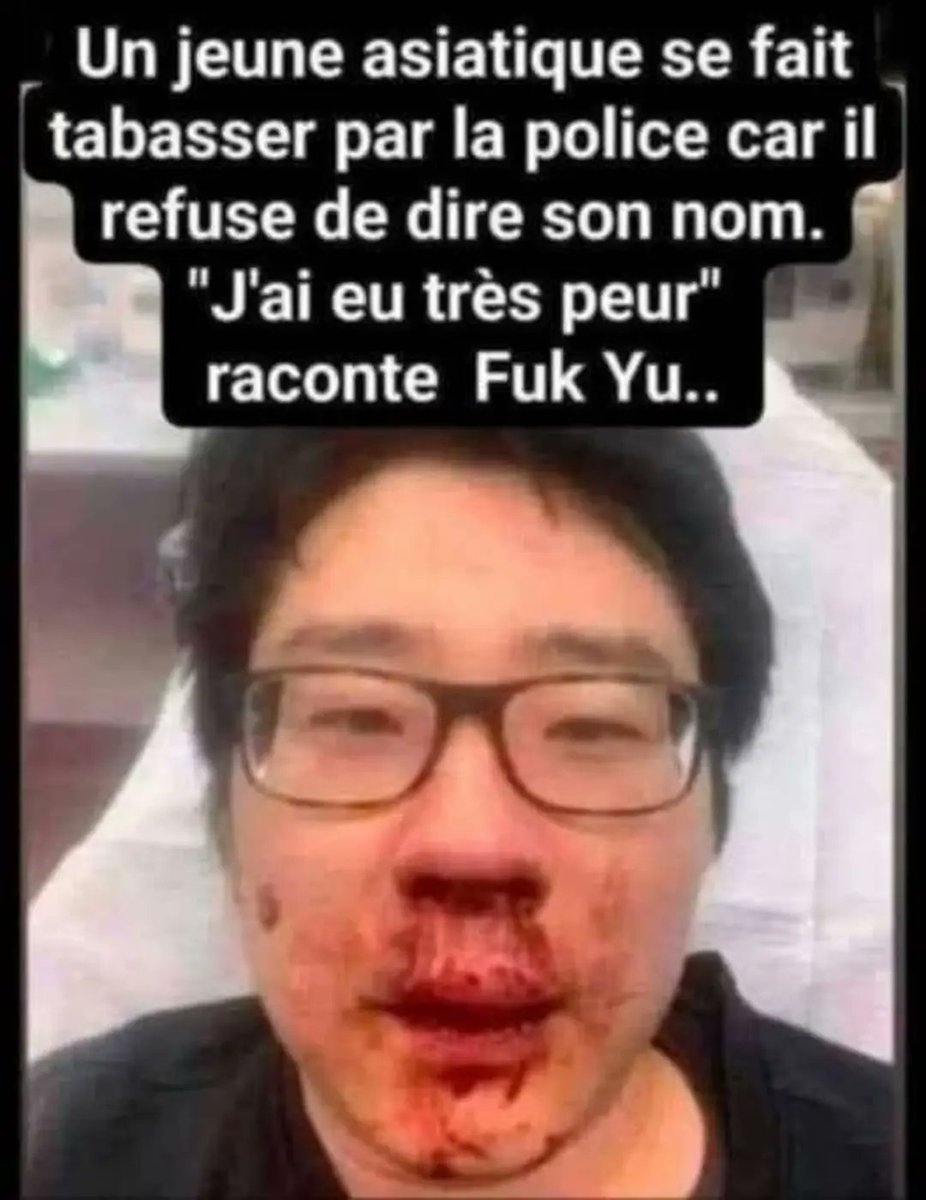 🥸🤪z'ont pas d'humour les flics🤪🥸
#humour