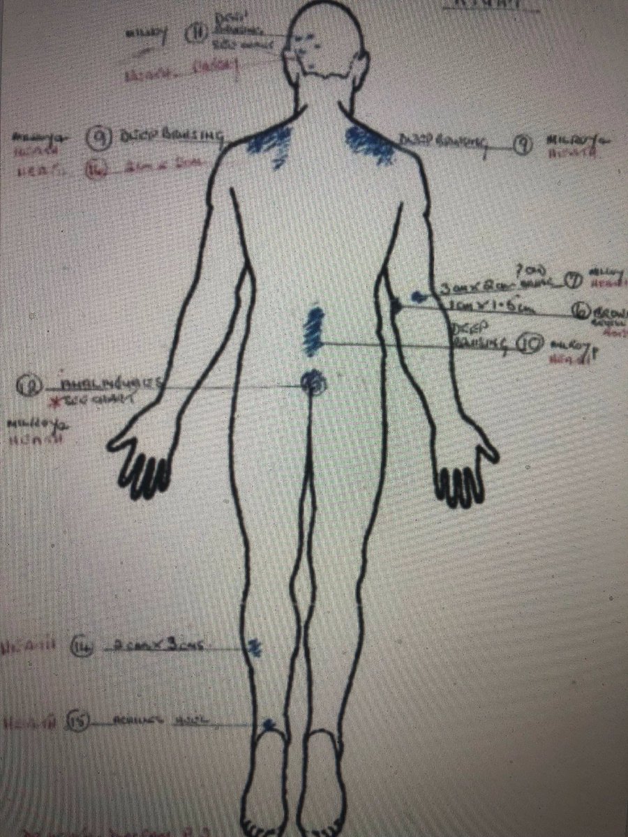 KarenBlade15's tweet photo. @WATV_SharonIndy @M_Steeples @SueOk38 @Naomi_TV Streaming on @Channel4. @Justice4Stuart @LubbockStuart. 9 people one late night after a nightclub meeting and carrying on the party #MichaelBarrymore's house. #StuartLubbock was #dead. Please watch #bodyinthepool. 40k reward @CrimestoppersUK #DCIStephenJennings @EssexPolice https://t.co/jRXkbcyt3c