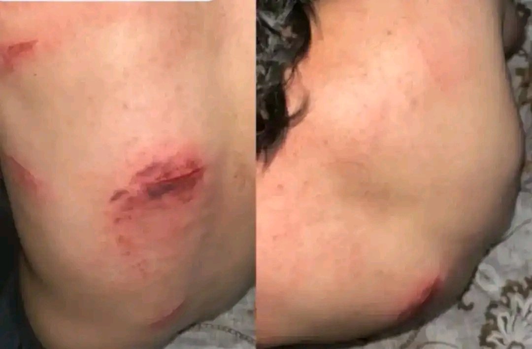 ArshadRazvi_'s tweet image. Justice is not served by bloodshed, nor is bravery proven by harming the helpless.
The true enemy is not the weapon, but the heart that chooses violence over compassion.

#Students
#PahalgamTerroristAttack
#studentattack