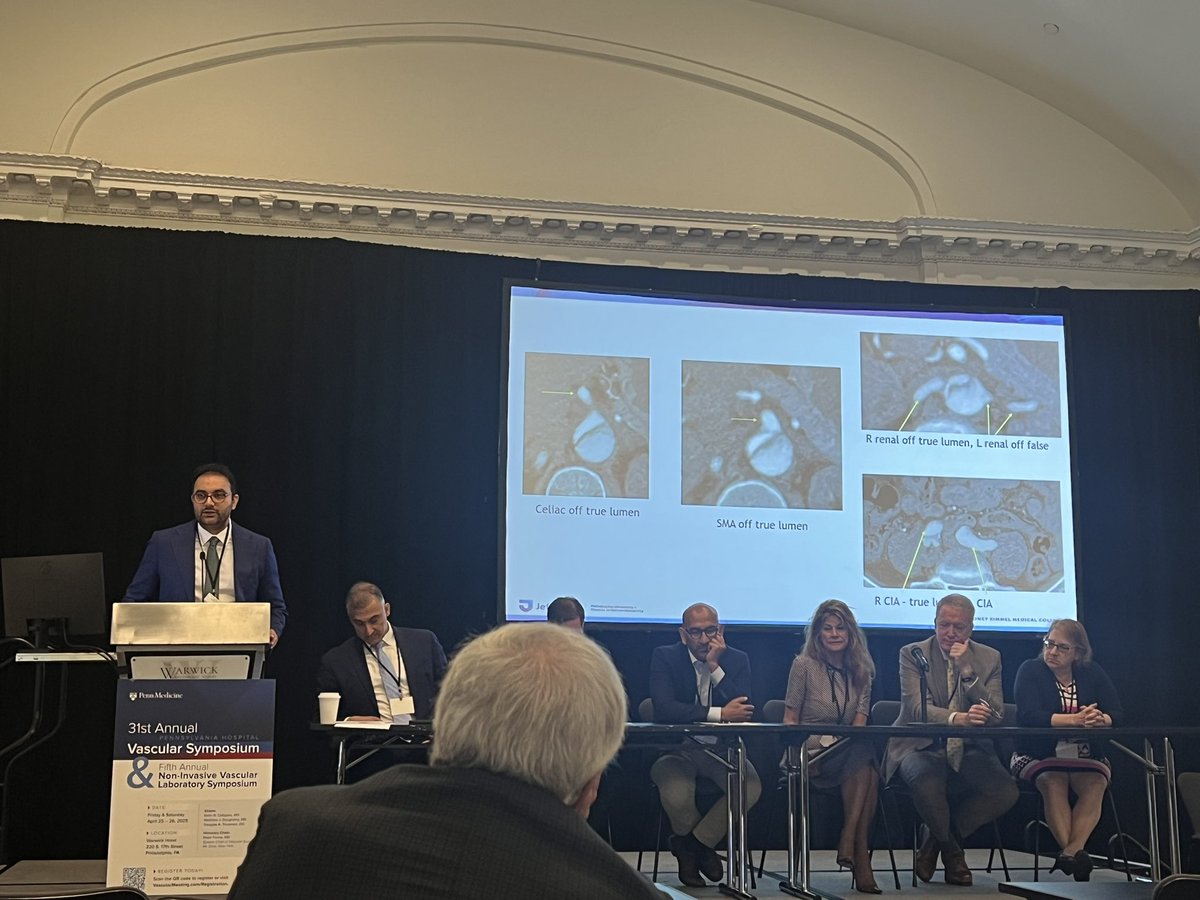 Excellent presentations today by senior fellow, Dr Gaurang Joshi, on management of complicated #TBAD at Pennsylvania Hospital Vascular Symposium ! #AortaEd #vascularsurgery