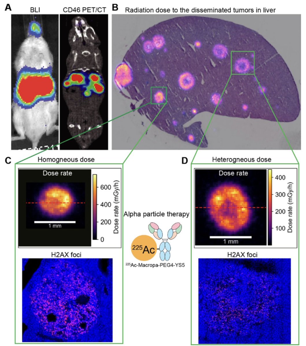 Effective treatment of disseminated #ProstateCancer using CD46-targeted 225Ac therapy. #AuthorCommentary New hope for PSMA-negative #ProstateCancer: CD46-targeted 225Ac alpha therapy shows strong preclinical efficacy in disseminated mCRPC models. Early treatment = better