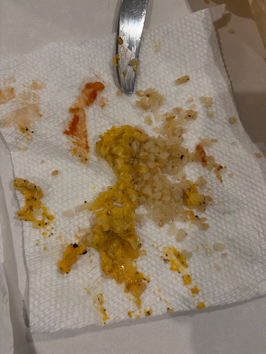 DBoone30's tweet photo. C’mon @McDonalds you’ve gotta do better. I ordered a triple cheeseburger with NO ONIONS. Instead, look at the ridiculous amount of onions they put on there. On every patty. Under the cheese. Everything was cold by the time I removed the onions. @Wendys would have gotten it right! https://t.co/qEuEwFyDzQ