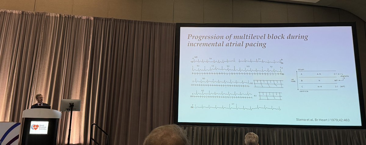 Our esteemed faculty Drs. Pinski and Kaplan talking about heart block at #HRS2025!