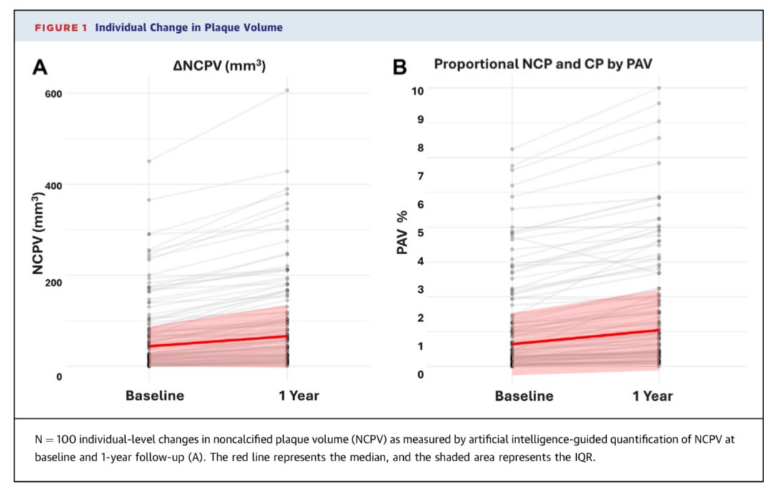 🙌Outstanding

🙏🏻Thanks to the Lean Mass HyperResponder study published in JACC: Advances, we now have a modern, real-world confirmation of what decades of science have consistently proven:

High LDLc causes atherosclerosis. 🫀📈

No matter how “metabolically healthy” you are,