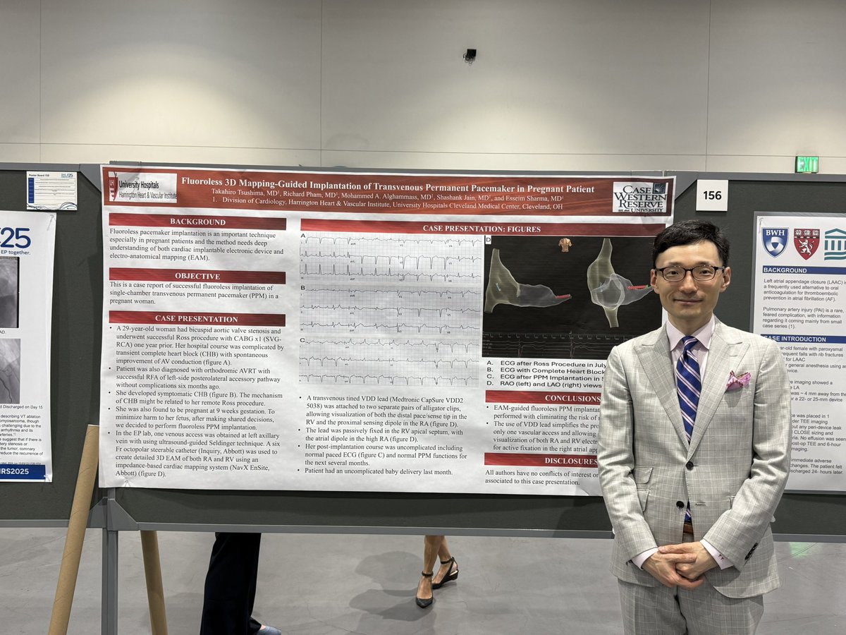 Shashank Jain, MD FACC (@leadinleadout) on Twitter photo So proud of our fellows Ali Azeem and Takahiro Tsushima for presenting some of the amazing EP work being done at <a href="/HarringtonHVI/">UH Harrington Heart & Vascular Institute</a> at #HRS2025 <a href="/HRSonline/">Heart Rhythm Society</a> <a href="/EsseimS/">Esseim Sharma, MD</a> So proud of our fellows Ali Azeem and Takahiro Tsushima for presenting some of the amazing EP work being done at <a href="/HarringtonHVI/">UH Harrington Heart & Vascular Institute</a> at #HRS2025 <a href="/HRSonline/">Heart Rhythm Society</a> <a href="/EsseimS/">Esseim Sharma, MD</a>
