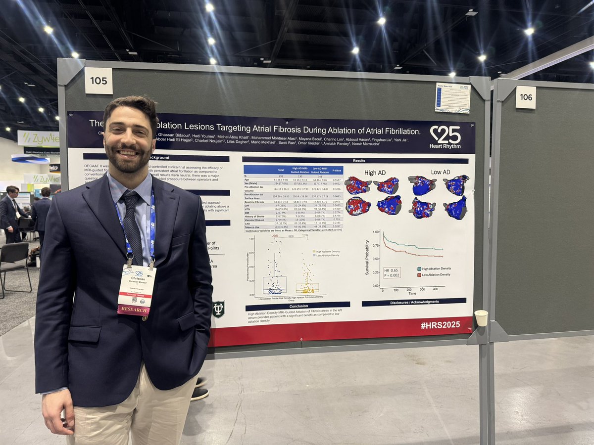Mayana Bsoul (@bsoulmayana) on Twitter photo Amazing work by <a href="/MassadChristian/">Christian Massad</a>!
Ablation density — defined by the number of ablation points per LA surface area — matters.
Higher ablation density was associated with 35% lower atrial arrhythmia recurrence! #HRS2025
<a href="/nmarrouche/">Nassir Marrouche</a> <a href="/TulaneTriad/">TulaneTRIAD</a> Amazing work by <a href="/MassadChristian/">Christian Massad</a>!
Ablation density — defined by the number of ablation points per LA surface area — matters.
Higher ablation density was associated with 35% lower atrial arrhythmia recurrence! #HRS2025
<a href="/nmarrouche/">Nassir Marrouche</a> <a href="/TulaneTriad/">TulaneTRIAD</a>
