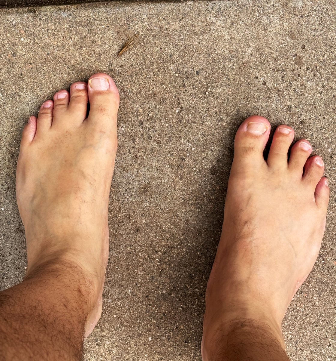 2fingersfusion's tweet photo. Bet you’ve never seen toes like these before… Dare you to look closer.
#onlyfans #feetworshi̇p https://t.co/6hu5U2oHFK