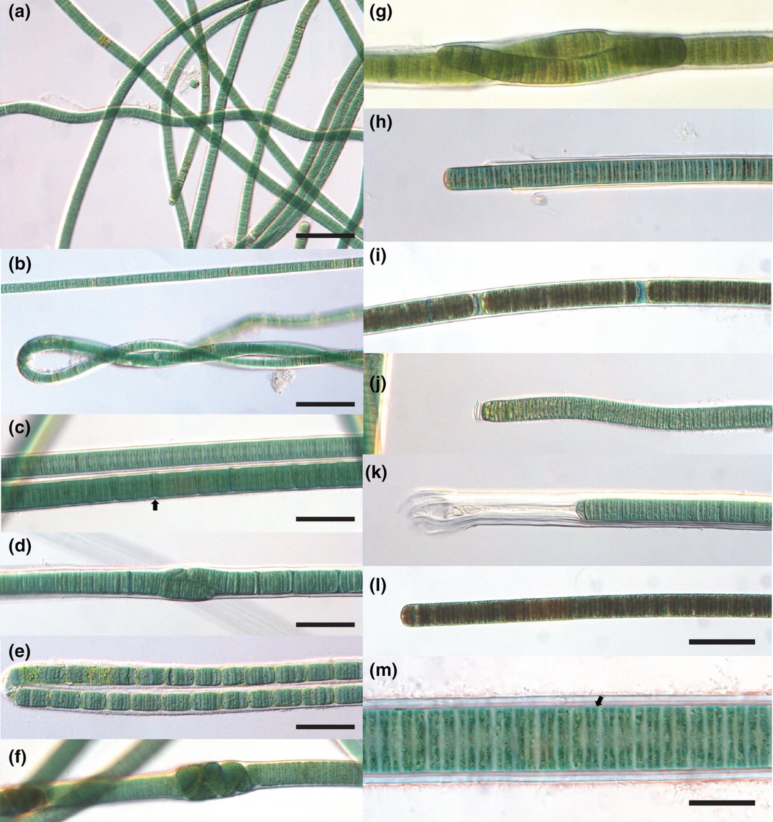 DNA #sequencing has rapidly improved taxonomy of #benthic #cyanobacteria. Using a polyphasic approach, Moretto et al. have added a new genus to the growing list.

Read about Floridanema—a taxa whose sequences were originally classified as Phormidium—here: doi.org/10.1111/jpy.13…