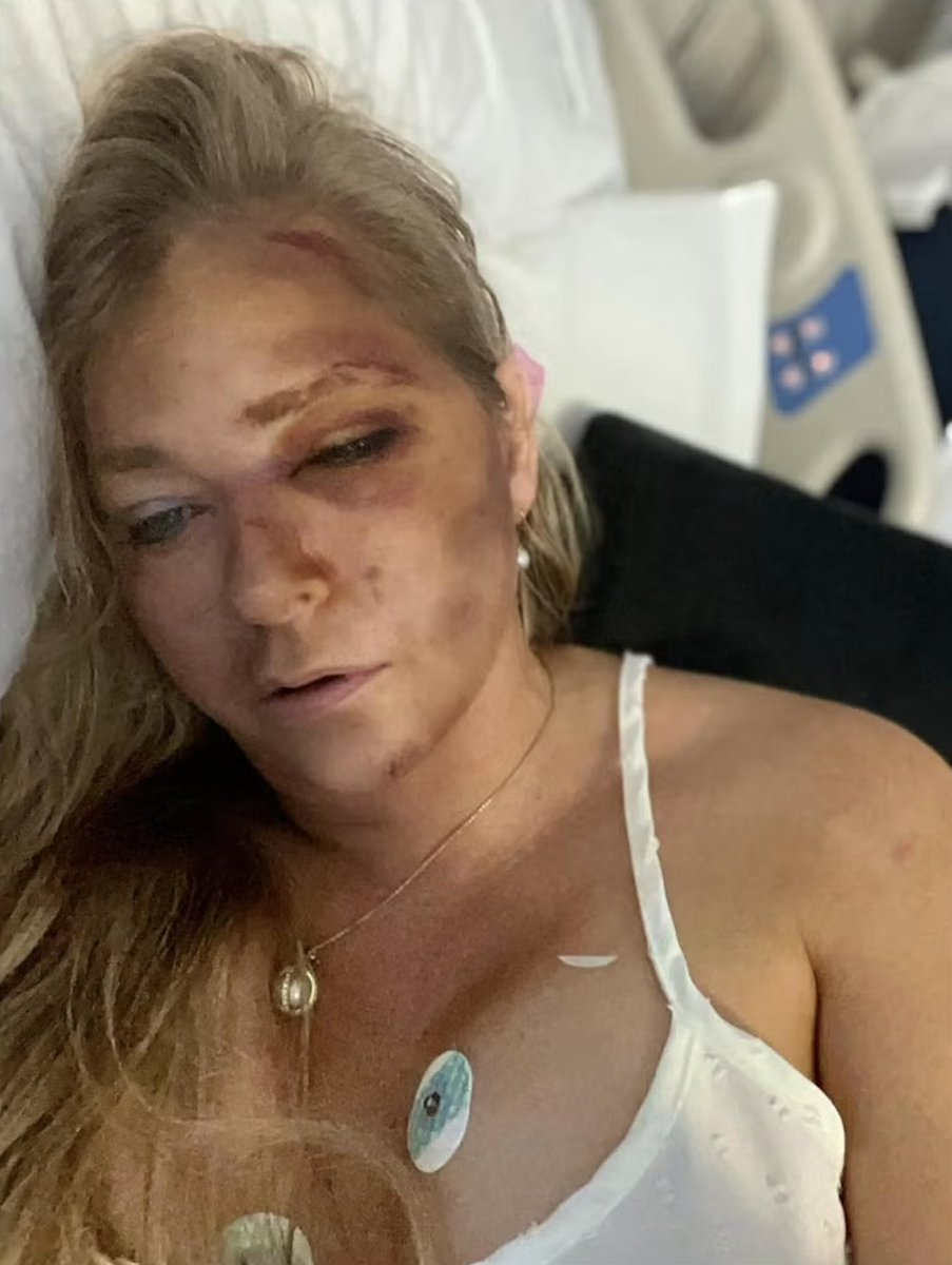 URECOMM's tweet image. 🚨 BREAKING: Virginia Giuffre, Jeffrey Epstein trafficking survivor, has tragically died by suicide, her family confirms to NBC News.