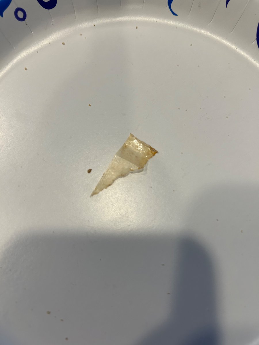 knowsalot453's tweet photo. @SantinosPizza I found a piece of plastic in my pizza https://t.co/R0hzV4YvyP