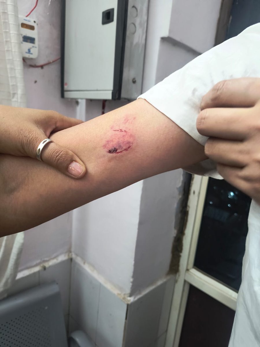 manish_adhikaar's tweet photo. @CMOfficeUP @noidapolice @dgpup @Uppolice 
On 24 Apr 2025 I along with my family wife and daughter was assaulted by local goons inside Ajnara Homes society with sticks. Also the goons Kamal Chaudhary and Pawan Chaudhary has threatened to kill me.
Please take necessary action. 🙏🏻 https://t.co/zRMltaUZja