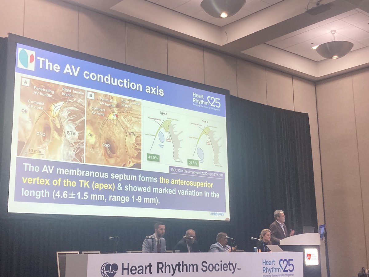 Marta Lorente Ros (@mlorenteros) on Twitter photo Very insightful talk by the great <a href="/jacabreracardio/">Dr. José Ángel Cabrera</a> on anatomy of the conduction system at #HRS2025! 🇪🇸 <a href="/HRSonline/">Heart Rhythm Society</a> <a href="/CardioQuironMad/">CardioQuironMadrid</a> Very insightful talk by the great <a href="/jacabreracardio/">Dr. José Ángel Cabrera</a> on anatomy of the conduction system at #HRS2025! 🇪🇸 <a href="/HRSonline/">Heart Rhythm Society</a> <a href="/CardioQuironMad/">CardioQuironMadrid</a>