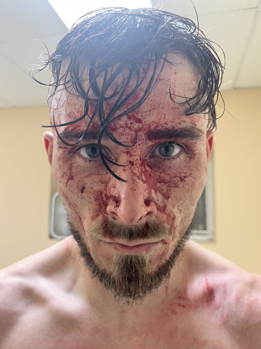 Last night at Midwest Championship Wrestling - Illinois Myself and Chris “Wild Card” Mercer went to WAR in a MCW STREET FIGHT

Despite losing the matchup, the amount of love I have for Professional Wrestling was on full display and ALL of your support means the most!🖤