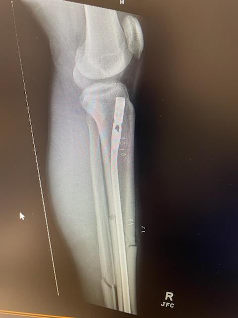 Randy Fulmore III tweet media