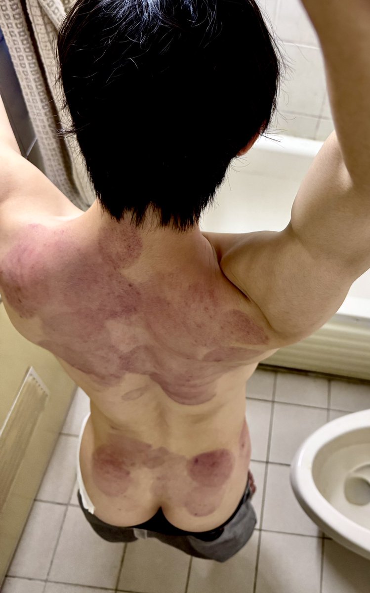殘破的身體
