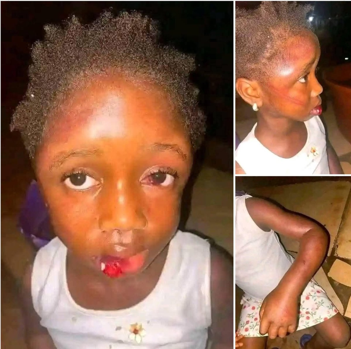 This is wild😭

How can you get a 5 years old as a house help? 😭😭😭😭

A woman with a popular name called FA who is a resident of Murray town Barracks allegedly beats this 5-year-old girl merc!lessly for taking food from a pot to eat unknown to her after she deprived her