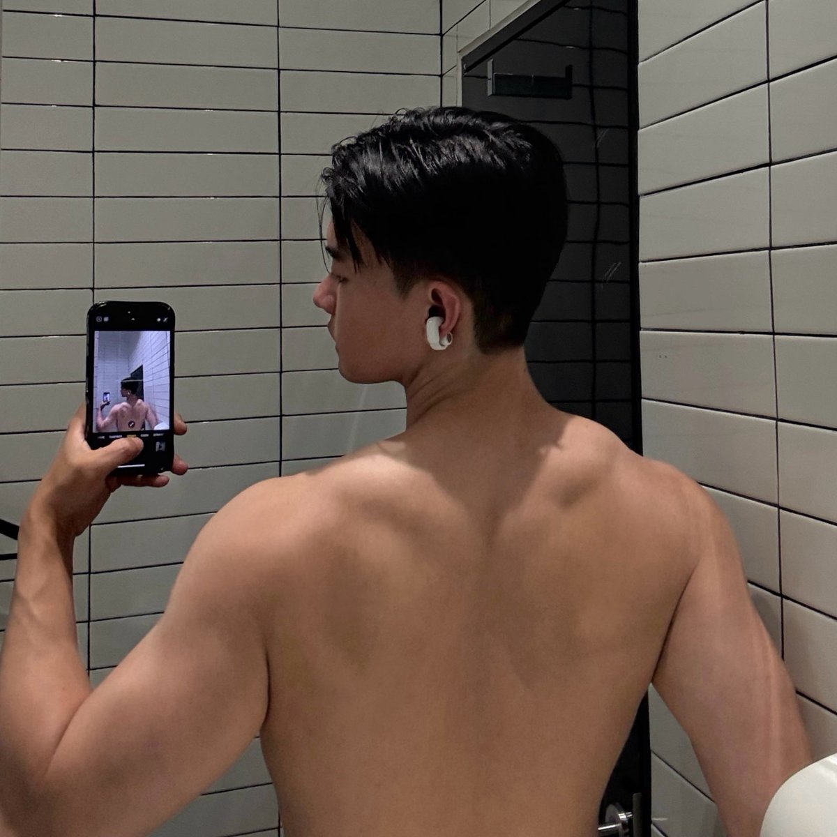 Trick หลังเนียน ไม่มีสิว

ปรกติสิวที่หลัง ไหล่ อก เกิดจาก yeasts เรียกว่า Pityrosporum Folliculitis

ใช้
- Bifonazole cream วันละครั้ง ไม่ก็ Clotrimazole cream วันละ 2 ครั้ง
- Anti-fungal shampoo สัปดาห์ละ 1-2ครั้ง
- Trifarotene มาบางๆ ก่อนนอน ตามด้วย moisturizer หนาๆป้องกันแสบ