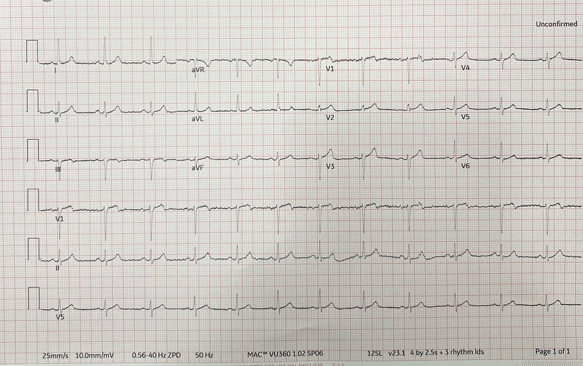 An interesting case with acute chest pain