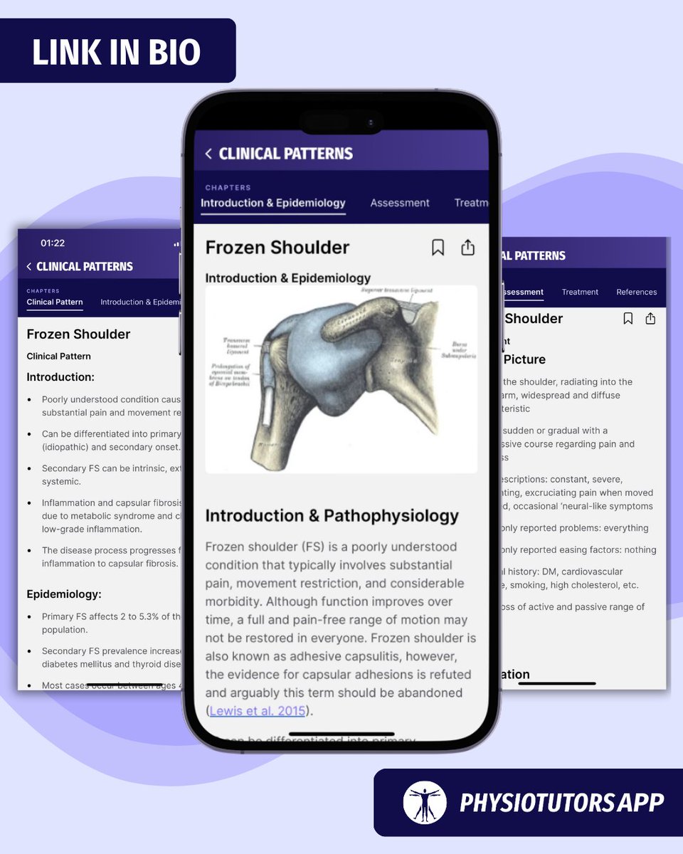 📱The Clinical Patterns feature on the Physiotutors app gives you fast, structured access to the most common musculoskeletal pathologies
⁠
🔗 physiotutors.com
⁠
#physiotutors #clinicalpatterns #msk #orthopaedics #physiotherapy #physicaltherapy #clinicalreasoning