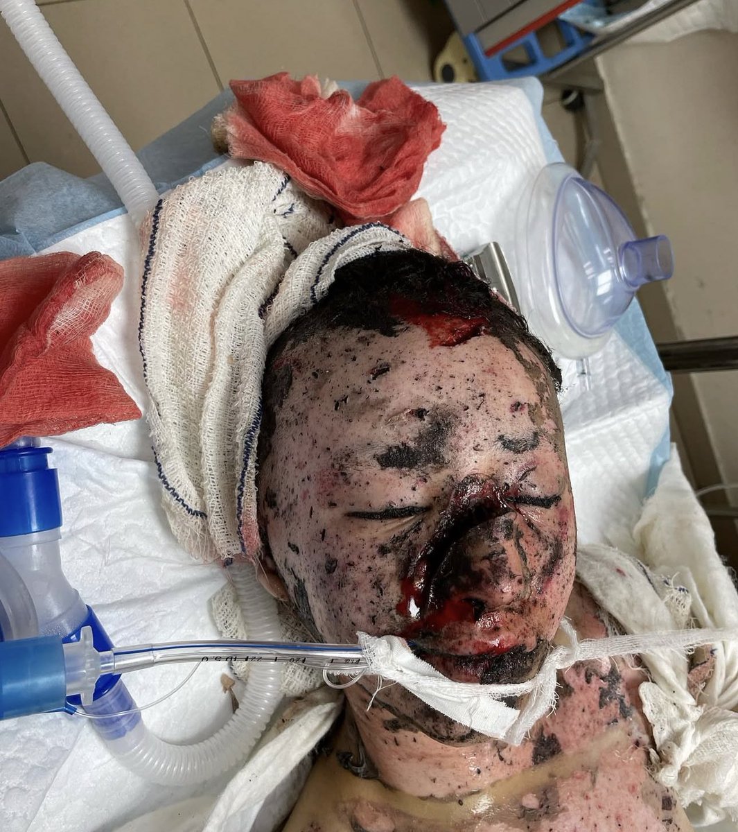 Drop a ❤️ for this little angel! 😔🇵🇸
Pray for her, don't stop talking about our children!