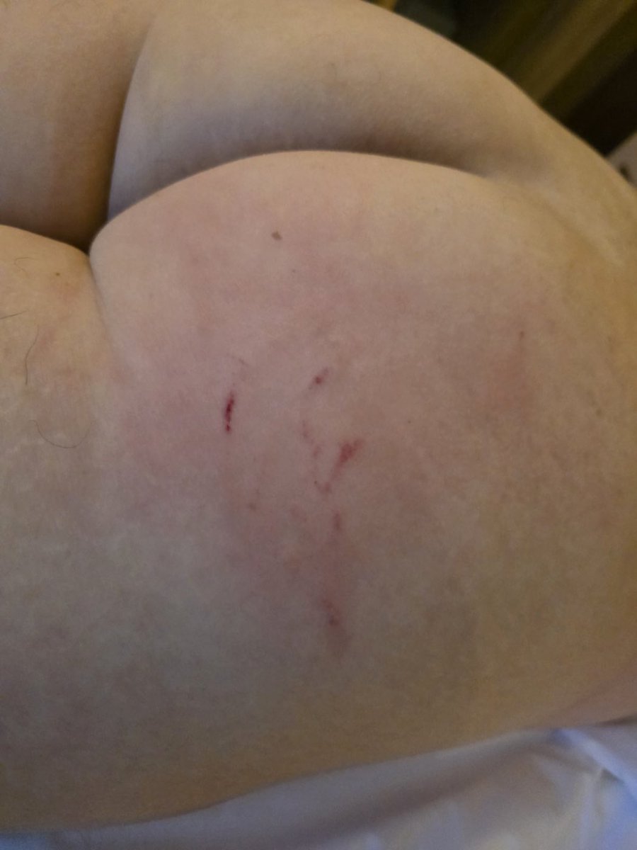 썸남이 손으로 때려준 복숭아🥰