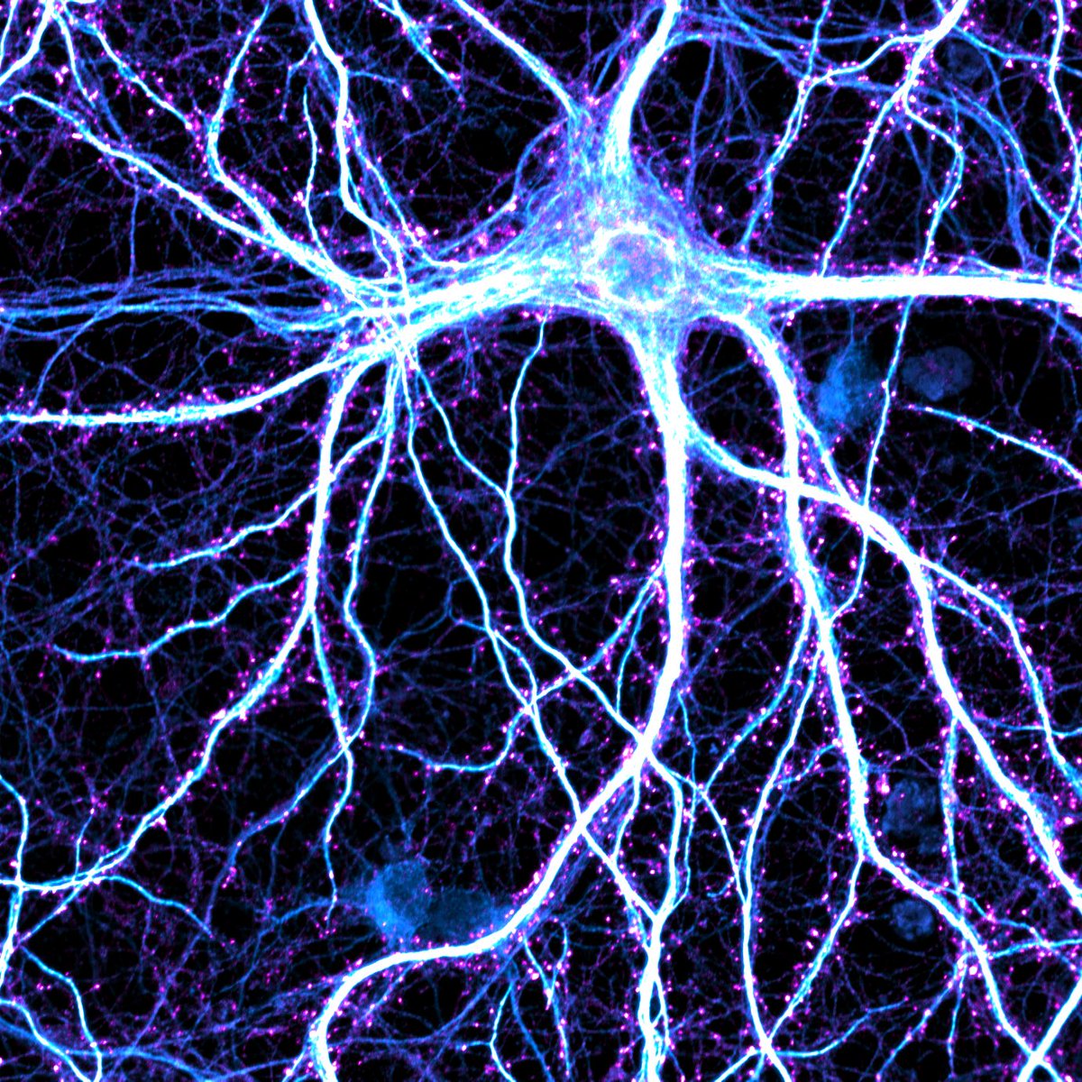Nevena Stajković (@cheerful_neuron) on Twitter photo Spare a sec? Boost a beautiful neuron with one click! 😉 #neuron #microscopy #synapse <a href="/NEInterfacesLab/">Neuroelectronic Interfaces (NEI) Lab</a> Spare a sec? Boost a beautiful neuron with one click! 😉 #neuron #microscopy #synapse <a href="/NEInterfacesLab/">Neuroelectronic Interfaces (NEI) Lab</a>