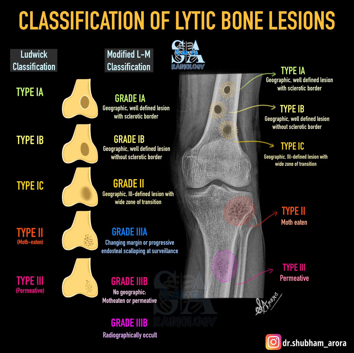 Dr_S_Arora's tweet image. Slide on Lytic bone lesions on radiograph.
#radiology #medX