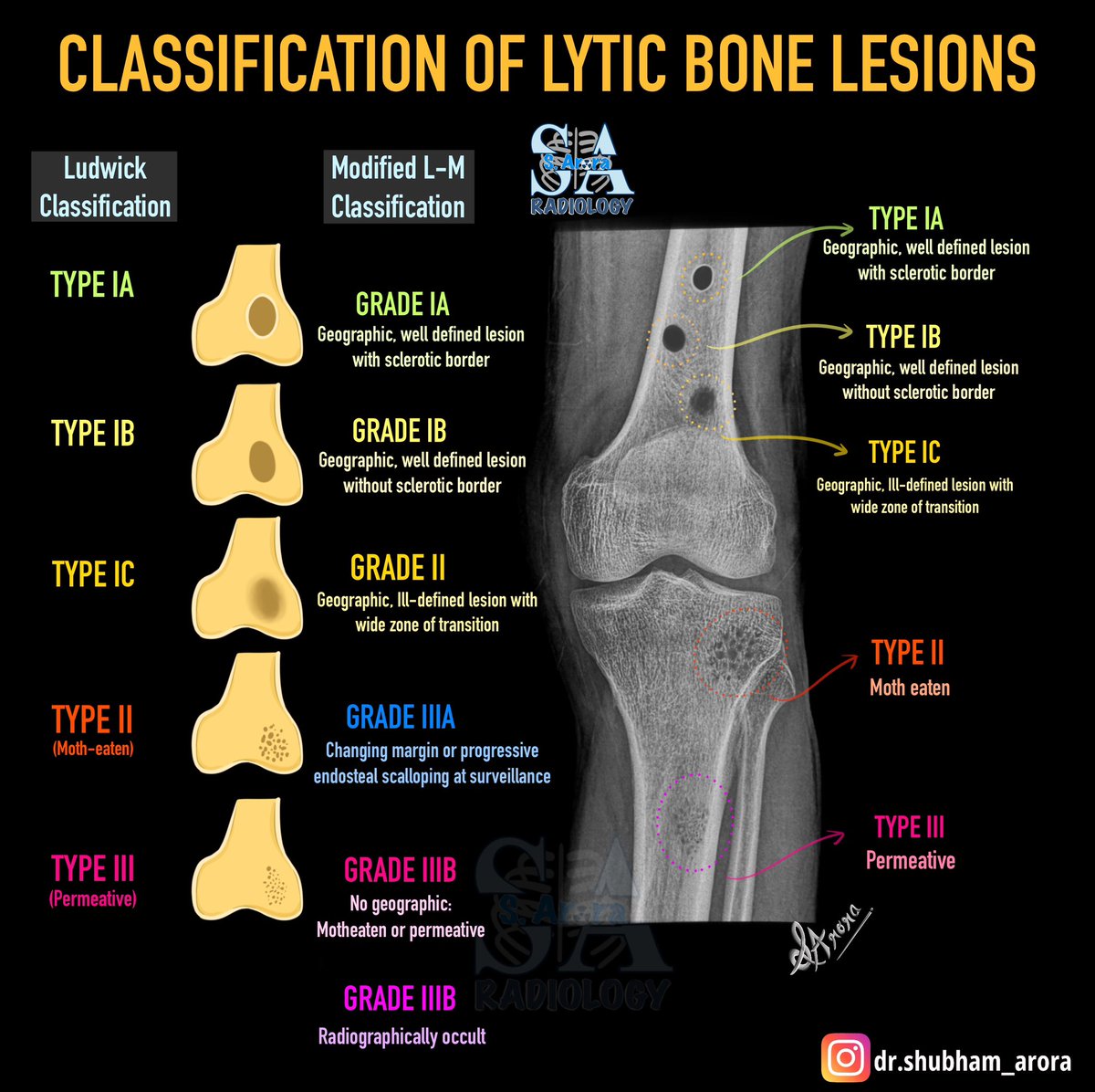 Dr_S_Arora's tweet image. Slide on Lytic bone lesions on radiograph.
#radiology #medX