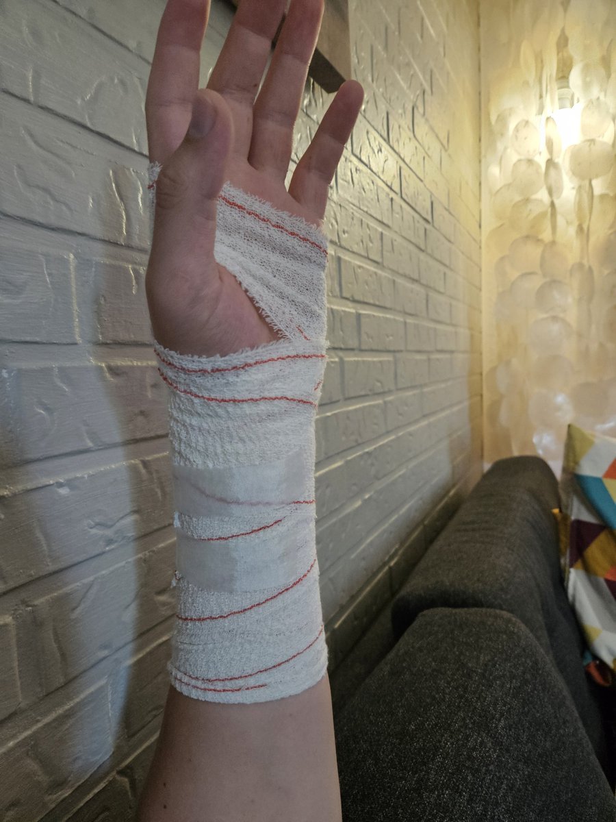 Surgery went well and feeling very minimal pain, healing should hopefully be quick!