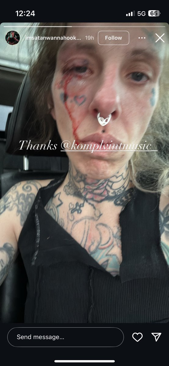 hey <a href="/travismelling/">komplvint</a> AKA KOMPLVINT… you like hitting women? fuck you, dude. i hope she dumps your bitch ass and puts you behind bars. fuck you and your dogshit music 👍