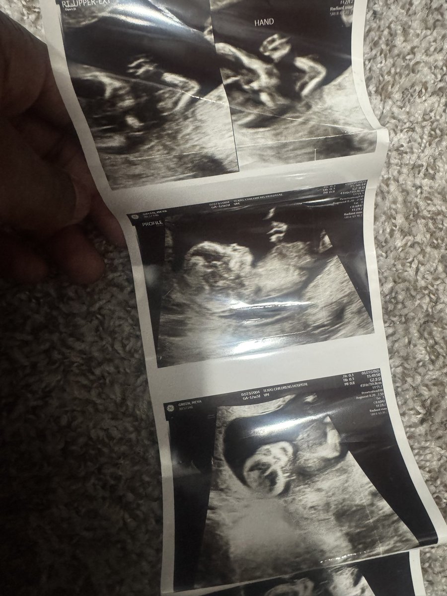 FrankDaSpeed tweet media