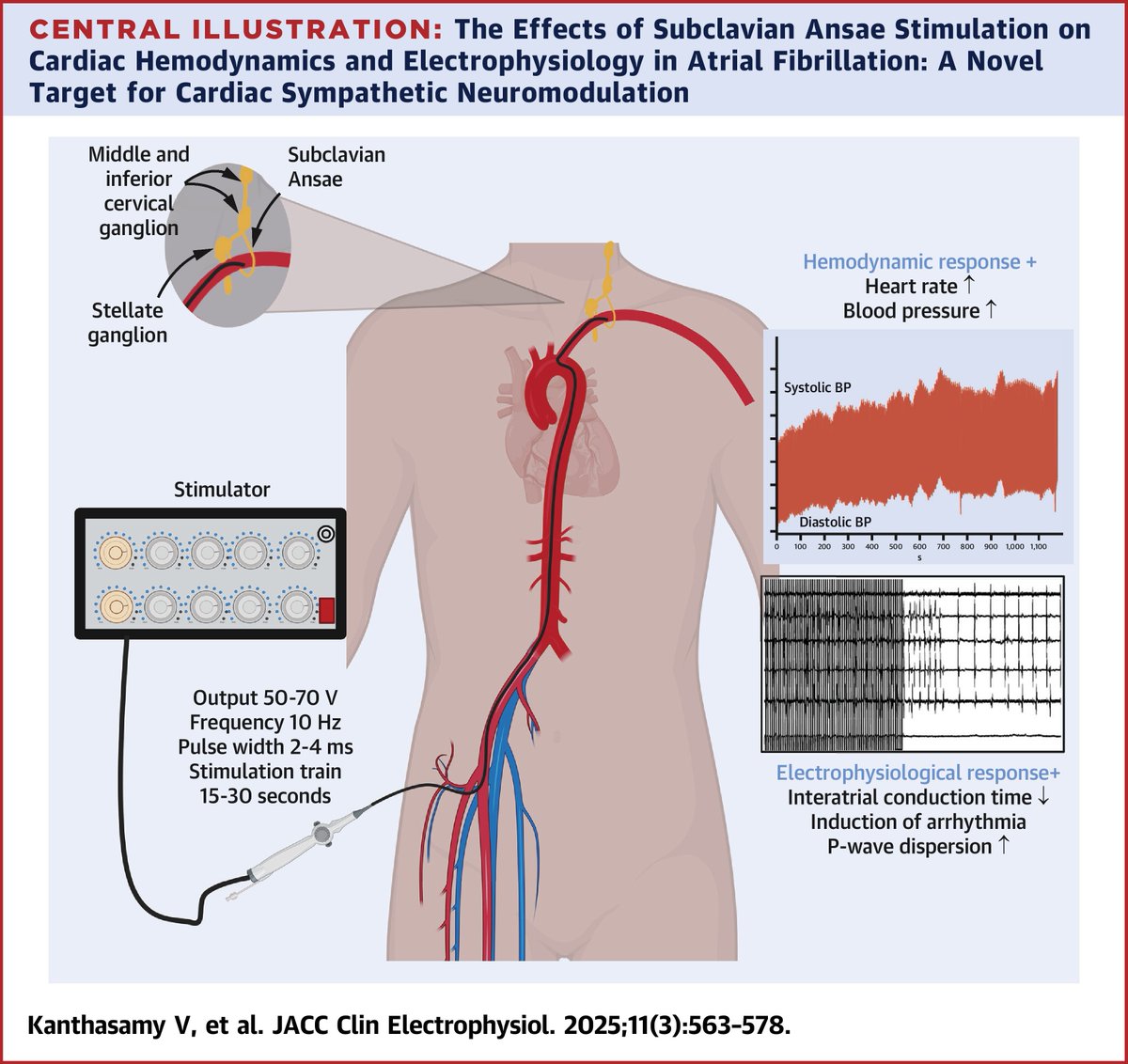 JACC Journals (@jaccjournals) on Twitter photo #JACCCEP study represents the first successful application of selective subclavian ansae stimulation (SAS) in humans. The SA is a potentially important site for targeted autonomic neuromodulation therapy. jacc.org/doi/10.1016/j.…
#AFib <a href="/mcfinlay/">Dr Malcolm Finlay</a> #JACCCEP study represents the first successful application of selective subclavian ansae stimulation (SAS) in humans. The SA is a potentially important site for targeted autonomic neuromodulation therapy. jacc.org/doi/10.1016/j.…
#AFib <a href="/mcfinlay/">Dr Malcolm Finlay</a>