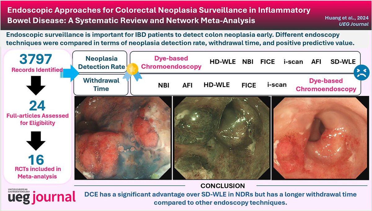 Keith Siau (@drkeithsiau) on Twitter photo IBD is a risk factor for colorectal cancer. With advances in optical diagnosis technology, which method is best for detecting neoplasia during IBD surveillance colonoscopy?
This meta-analysis in <a href="/UEGJournal/">UEGJ</a> shows that dye spray is still best 👑💦
📸: onlinelibrary.wiley.com/doi/10.1002/ue… IBD is a risk factor for colorectal cancer. With advances in optical diagnosis technology, which method is best for detecting neoplasia during IBD surveillance colonoscopy?
This meta-analysis in <a href="/UEGJournal/">UEGJ</a> shows that dye spray is still best 👑💦
📸: onlinelibrary.wiley.com/doi/10.1002/ue…