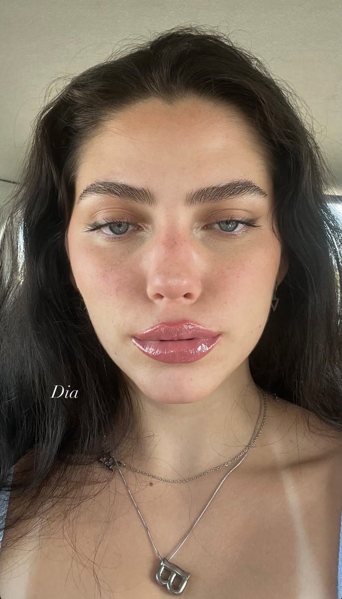 Dia.
