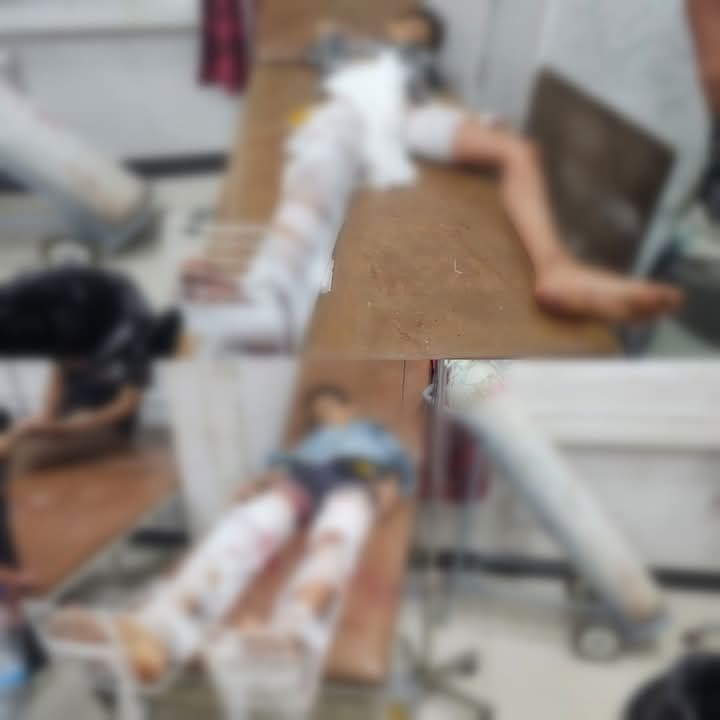 #عاجل 
#تعز |  إصـابــة الطفل سليمان هزاع (14 عاماً)
والطفل محمد عبدالرحمن (12 عاماً)
بـرصـــاص قنـــاص حوثي متمركز بتبة المدرجات في حي الدمينة تعز .