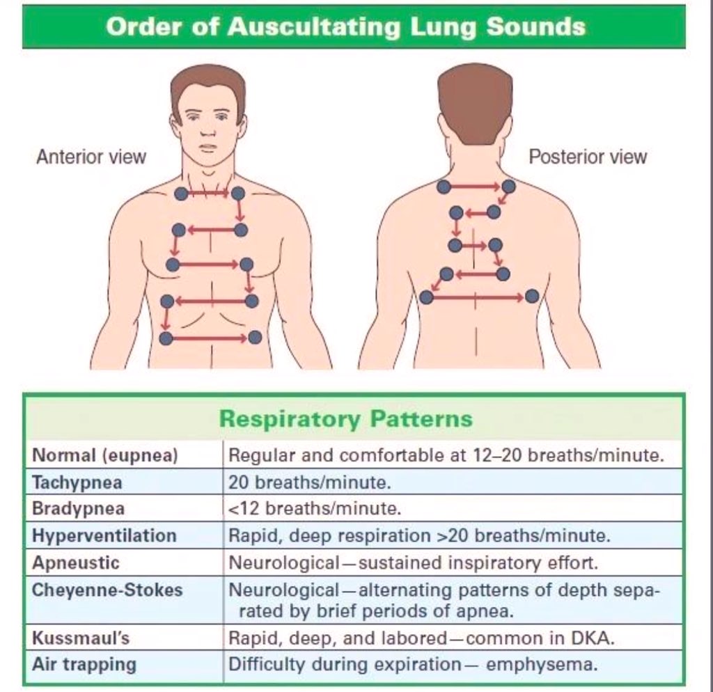 Doctors__squad's tweet image. Order of Auscultating Lung Sounds