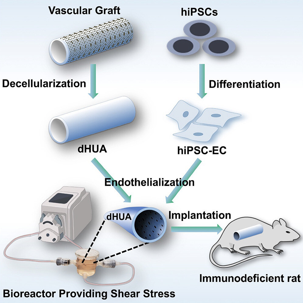 Fully biologic endothelialized-tissue-engineered vascular conduits provide antithrombotic function and graft patency
hubs.li/Q03gkKYM0
<a href="/YaleCVRC/">Yale CVRC</a>
Collection highlight from <a href="/CellStemCell/">Cell Stem Cell</a>