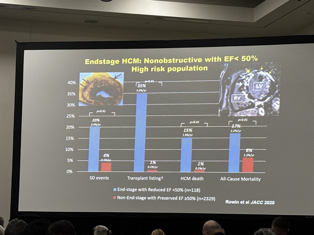 Amro Aglan (@amroaglanmd) on Twitter photo Amazing session on #HCM and arrhythmias — from the newer high-risk makers to challenges of VT ablation, role of PFA, and updated exercise guidelines. #EPeeps #HRS2025 #2025pacesetter <a href="/EthanRowin/">Ethan Rowin</a> Amazing session on #HCM and arrhythmias — from the newer high-risk makers to challenges of VT ablation, role of PFA, and updated exercise guidelines. #EPeeps #HRS2025 #2025pacesetter <a href="/EthanRowin/">Ethan Rowin</a>
